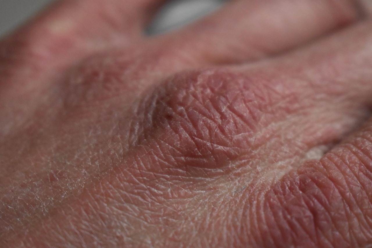 How Dry Skin Serum Can Transform Your Skincare Game?
