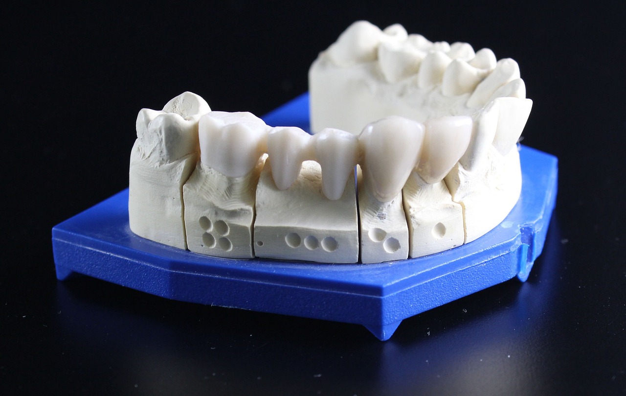 Aspen Dental Reviews in Ephrata, PA - Contractor Payment Still Pending