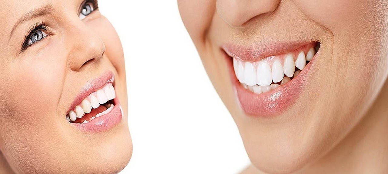 Discover The Best Cosmetic Dentistry In Tampa