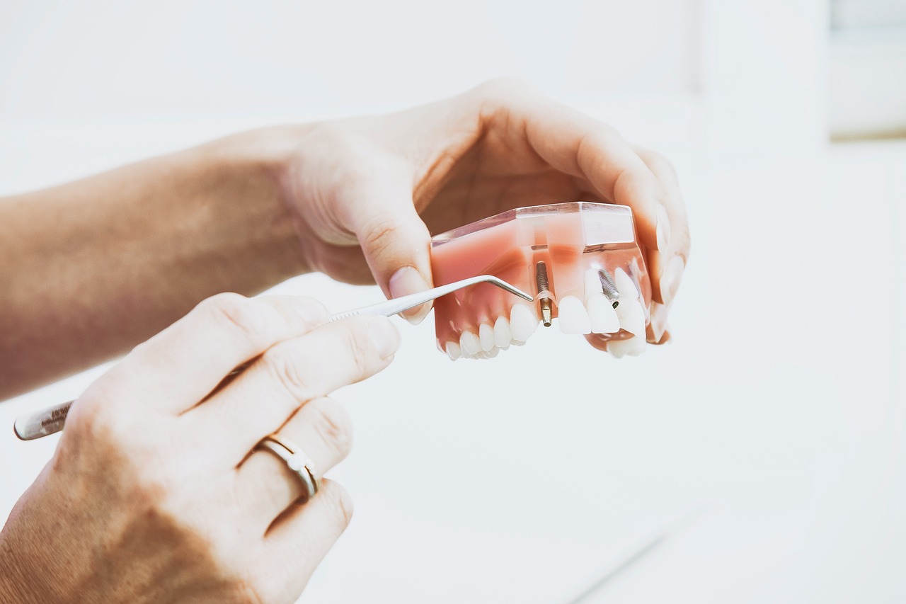 Top 5 Reasons You Might Need Emergency Dental In Tucson