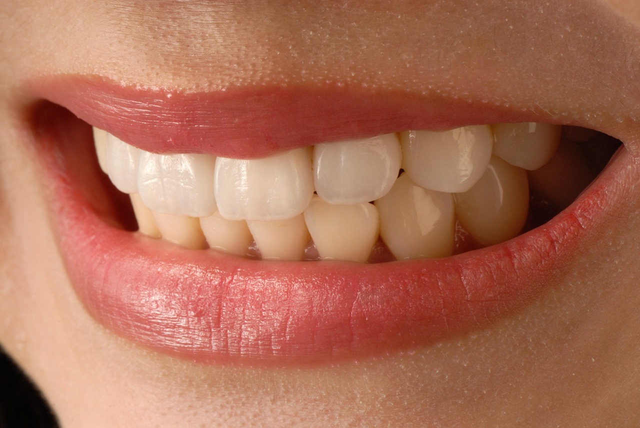 Why Choose Dental Veneers In Tucson For A Perfect Smile?