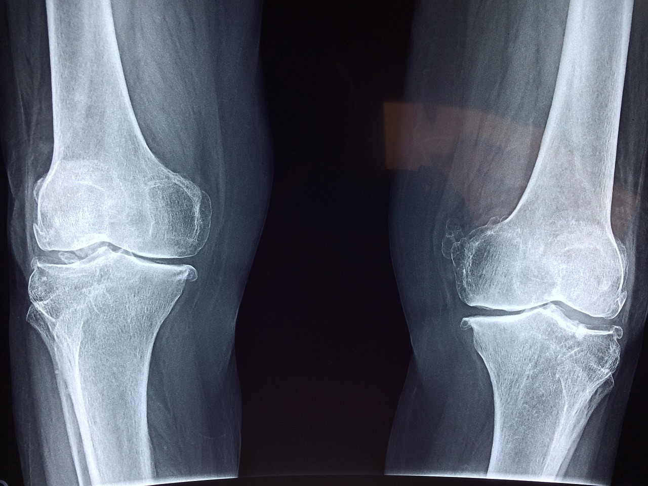 Top New Orleans Orthopedic Specialists: Expert Care For Joint And Bone Health