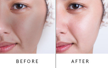glow face serum
