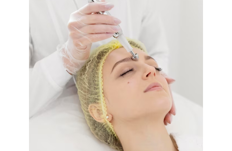 microneedling for scars