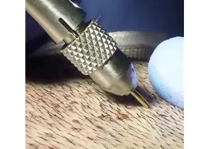 Hair Transplant In Istanbul